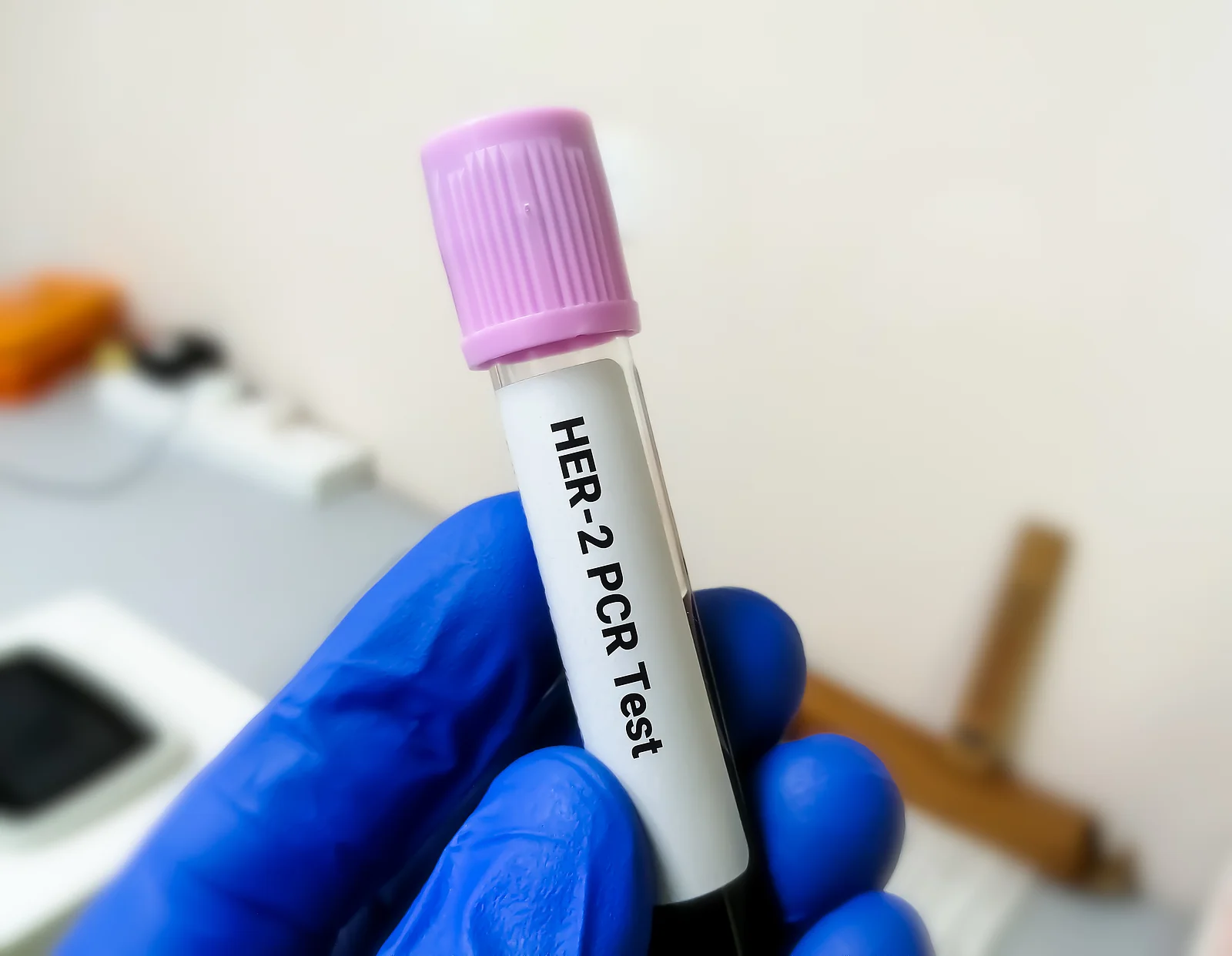 Blood sample for Her-2 or human epidermal growth factor receptor