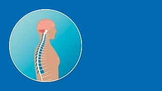 Teaserbild zum Überblick zur Multiplen Sklerose. Darstellung eines Menschen und einem Teil seines Nervensystems.