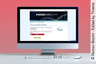 Computerbildschirm zeigt die Startseite der Thieme Infothek FokusRare.