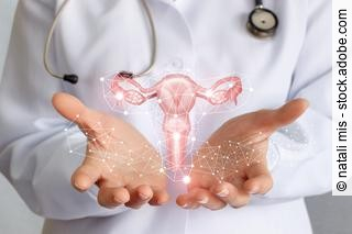 Illustration eines Uterus. © natali mis/stock.adobe.com