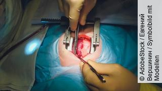 The process of cardiac surgery. The heart surgery.