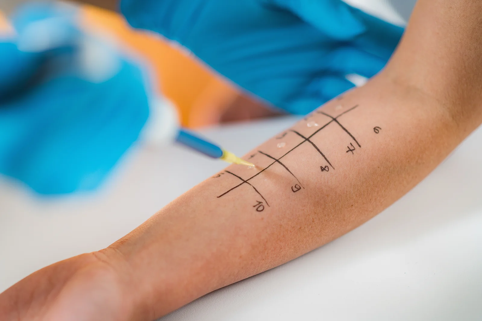 Allergy Testing Allergy Testing